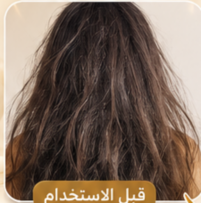 قبل استعمال صيروم الشعر SPF 50